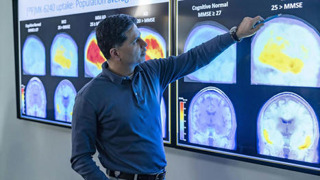 Debate sobre el alzhéimer: si no se puede curar, ¿para qué diagnosticar temprano? | Alzheimer y más (Boletín nº 70) | Scoop.it