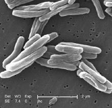 New compound excels at killing persistent and drug-resistant tuberculosis | Amazing Science | Scoop.it