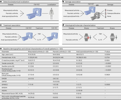 CD200+ fibroblasts form a pro-resolving mesenchymal network in arthritis | Nature Immunology | Rheumatology-Rhumatologie | Scoop.it