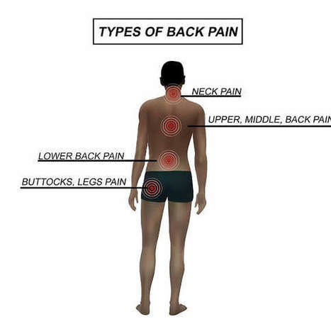 What Are The  Types of Back Pain? | Medical and Health | Scoop.it