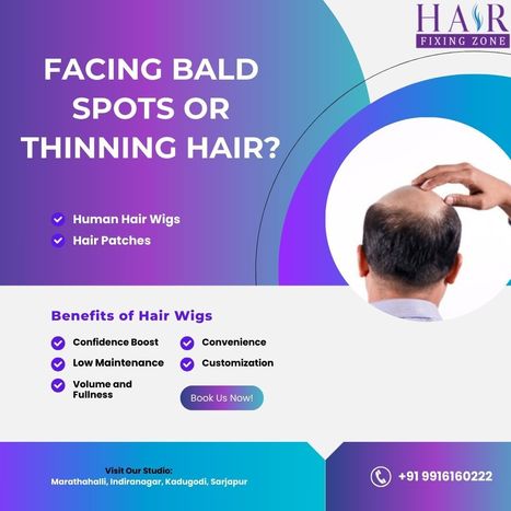 FACING BALD SPOTS OR THINNING HAIR? | hair fixing in bangalore | Scoop.it