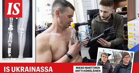 Hlib, 30, menetti sodassa kaksi raajaa &ndash; nyt h&auml;n ohjaa uutta k&auml;tt&auml;&auml;n rintalihasten avulla | 1Uutiset - Lukemisen t&auml;hden | Scoop.it