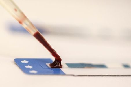Deux cas de contrôle spontané de l’infection par le VIH élucidés | actualités VIH, hépatites, IST, santé sexuelle | Scoop.it