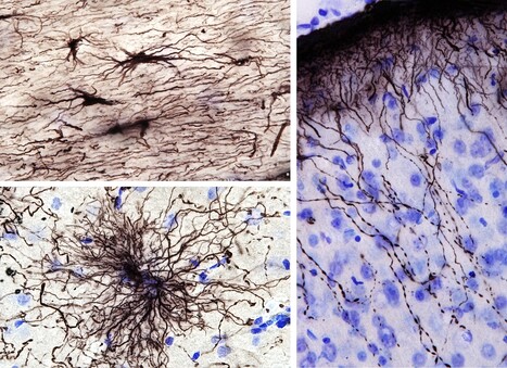 La grande diversit&eacute; des astrocytes &eacute;claire le vieillissement du cerveau | Life Sciences Universit&eacute; Paris-Saclay | Scoop.it