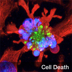 Fabulous Cell pictures for Students and Lecturers - Cell_Picture_Show | Immunology for University Students | Scoop.it