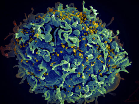 Study Identifies How Stealthy HIV Evades Drugs and Immunity | Virus World | Scoop.it