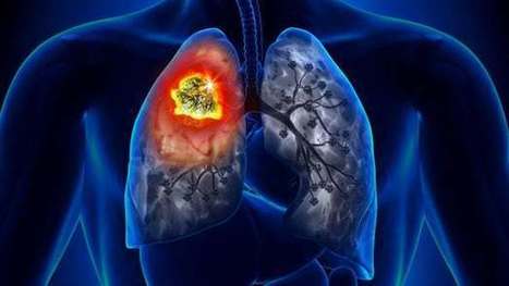 Promising new lung cancer treatment combines two pre-existing drugs | Longevity science | Scoop.it