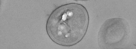 Le staphylocoque dor&eacute; est tr&egrave;s r&eacute;sistant et virulent dans le lait | Life Sciences Universit&eacute; Paris-Saclay | Scoop.it
