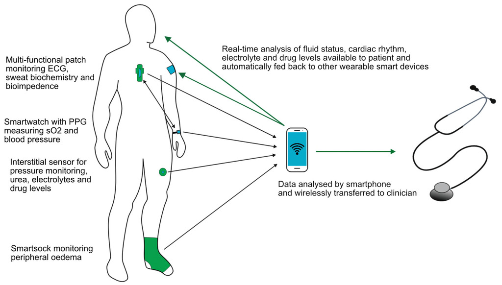 Withings announces new Body Scan smart scale with integrated ECG - General  Discussion Discussions on AppleInsider Forums