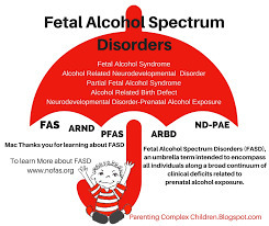 Estimation of national, regional, and global prevalence of alcohol use during pregnancy and fetal alcohol syndrome: a systematic review and meta-analysis | #TYTD2017 - Too young to drink - #FASD | Scoop.it