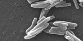 Vitamin C Slays TB Bacteria | Virology News | Scoop.it