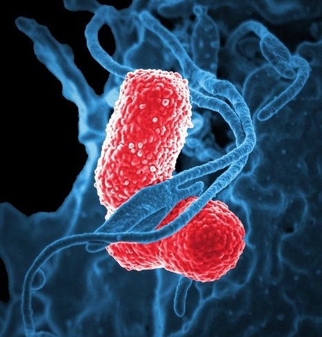 La pared bacteriana | Temas varios sobre Microbiología clínica | Scoop.it