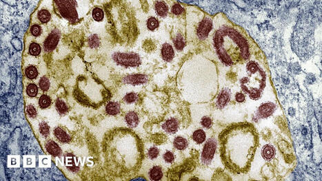 Marburg Virus in Rwanda: Six killed | Virus World | Scoop.it