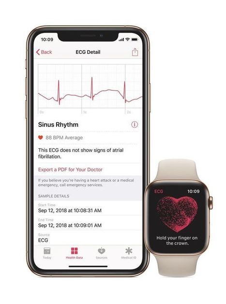 Johnson & Johnson teams with Apple study to help reduce the risk of strokes  | Pharma Hub | Scoop.it