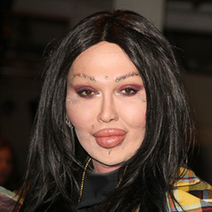 Shocking Celebrity Plastic Surgery Disasters