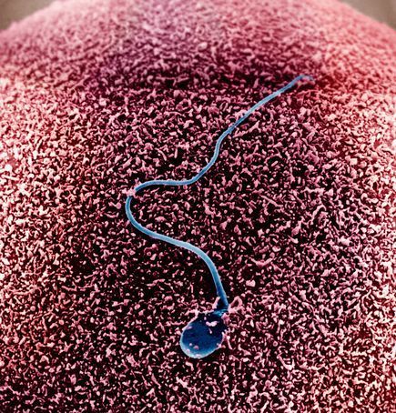 Sperm Tracked in 3-D—A First | Science News | Scoop.it