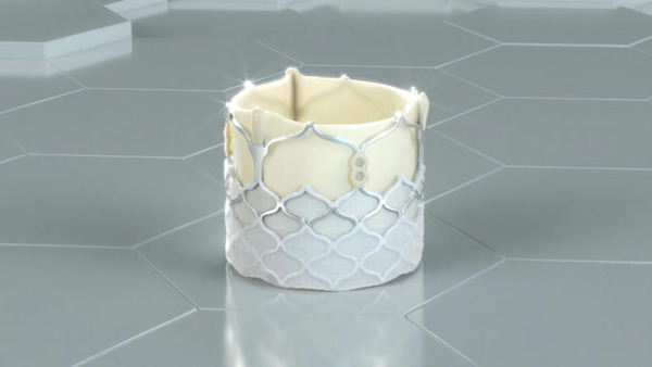 DurAVR transcatheter heart valve reaches 100 patients | Transcatheter Treatment of Mitral Regurgitation | Scoop.it