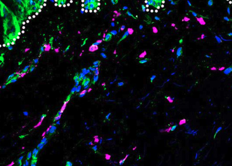 Dengue Severity Linked to Genetic Ancestry’s Influence on Immune Response | Virus World | Scoop.it
