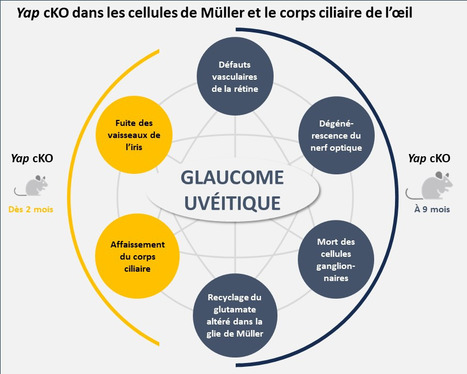 Etude du glaucome : Un nouveau modèle de souris révélé par la dérégulation du gène Yap | Life Sciences Université Paris-Saclay | Scoop.it