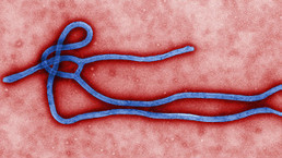 ¿Cómo controlar la epidemia de un virus que no tiene cura? - BBC Mundo - Noticias | Salud Publica | Scoop.it