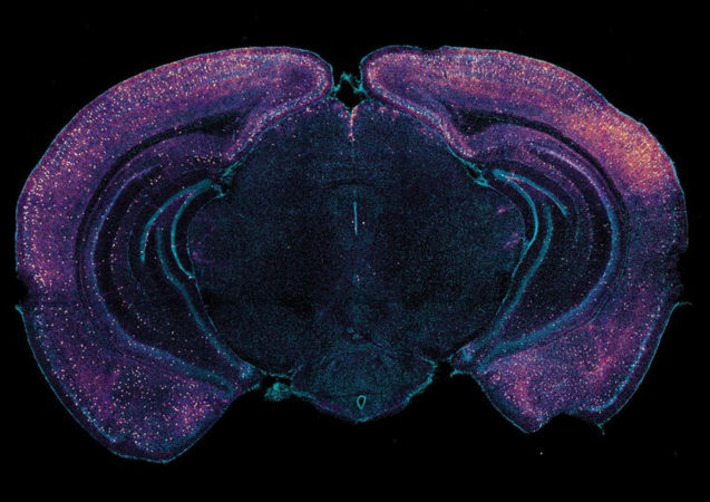 This Simple Device Could Finally Defeat Alzheimer&rsquo;s and Safeguard Your Memory | The Health Report | Scoop.it