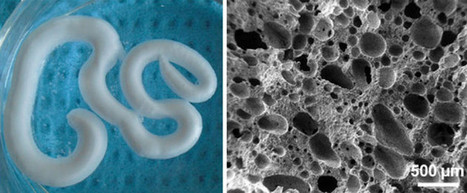 Scientists Create Injectable Foam To Repair Degenerating Bones | 21st Century Innovative Technologies and Developments as also discoveries, curiosity ( insolite)... | Scoop.it