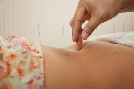 Acupuncture for Reducing Joint Pain in Lupus Patients | Call: 915-850-0900 | Mobility & Flexibility - Joint Movement | Scoop.it