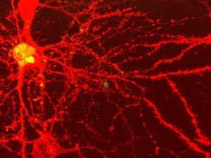 Embrasser la complexit&eacute; | R&eacute;seaux et m&eacute;dias sociaux, veille, technique et outils | Scoop.it