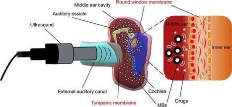 JCI Insight - Ultrasound-induced microbubble cavitation via a transcanal or transcranial approach facilitates inner ear drug delivery | Immunology and Biotherapies | Scoop.it