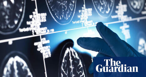 Effect of &lsquo;gamechanger&rsquo; Alzheimer&rsquo;s drugs &lsquo;trivial&rsquo;, review concludes | Hospitals and Healthcare | Scoop.it