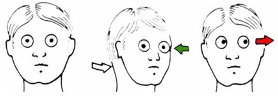 Глаз офтальмология. Дпдг емдр. Что то движется в глазу. Болит глаз при движении. Глаз вбок.