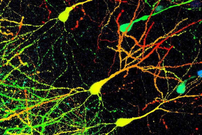 'Remarkable' discovery upends our understanding of how brains store memories | The Health Report | Scoop.it