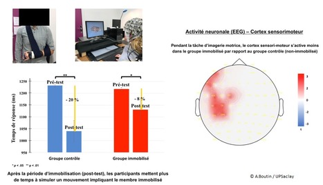 FOCUS PLATEFORME : Analyser l’activité cérébrale à haute résolution temporelle : Quid de la neuroplasticité du cortex sensorimoteur après une période d’immobilisation du membre supérieur ? | Life Sciences Université Paris-Saclay | Scoop.it