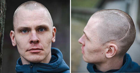 Niklas fick ett slag &ndash; sedan blev han hj&auml;rnskadad | 1Uutiset - Lukemisen t&auml;hden | Scoop.it