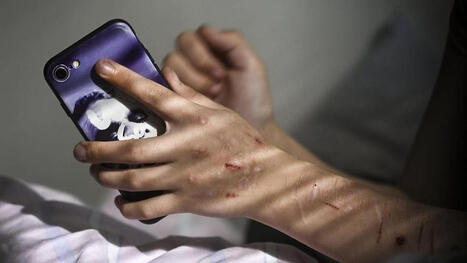 Viiltely on ainut helpottava keino, sanoo moni lapsi ja nuori | 1Uutiset - Lukemisen t&auml;hden | Scoop.it