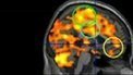 Scans show meditation brain boost | Science News | Scoop.it
