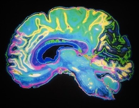 New technology guides immune cells to fight brain cancer and multiple sclerosis | Genetic Engineering Publications - GEG Tech top picks | Scoop.it