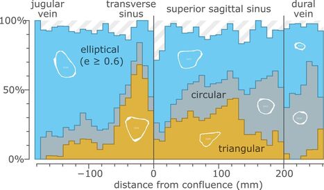 Characterizing superficial cerebral cortical venous anatomy for endovascular device implantation: a cross-sectional imaging study | Brain Computer Interfaces & connected medical devices | Scoop.it