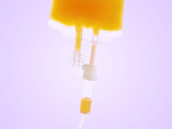 Can Swapping Out Your Plasma Slow the Aging Process? | The Health Report | Scoop.it