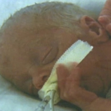Congressional Budget Office: 30 Late-Term Abortions Each Day | Christian Spiritual Counseling | Scoop.it