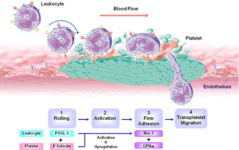 Vascular Inflammation and Repair: Implications for Re-Endothelialization, Restenosis, and Stent Thrombosis | Neurovascular Intervention | Scoop.it