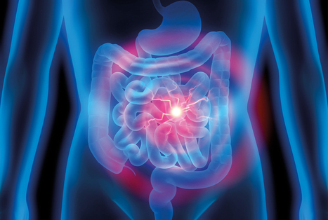 Vers des bithérapies pour le traitement de la rectocolite hémorragique | Life Sciences Université Paris-Saclay | Scoop.it