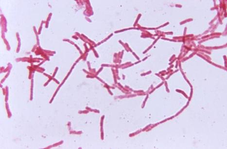 The Right Cocktail of Gut Microbes may Prevent or Reverse Food Allergies | Microbiology | Allergy (and clinical immunology) | Scoop.it