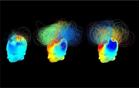 Hidden Consciousness in Vegetative Patients Could Be Detected by Simple Bedside Test | Dépendance et fin de vie | Scoop.it