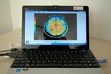 La campagne p&eacute;rigourdine s'int&eacute;resse &agrave; la t&eacute;l&eacute;m&eacute;decine | 8- TELEMEDECINE & TELEHEALTH by PHARMAGEEK | Scoop.it