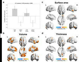 Learning a second language helps maintain a s | Bilingually Enriched Learners | Scoop.it