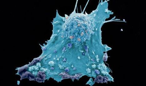 Descubiertas unas ‘células escudo’ que protegen los tumores | Immunopathology & Immunotherapy | Scoop.it