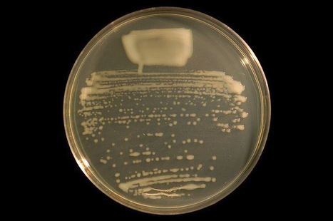 Mesorhizobium loti: a bacterium with many friends | Plant-Microbe Symbiosis | Scoop.it