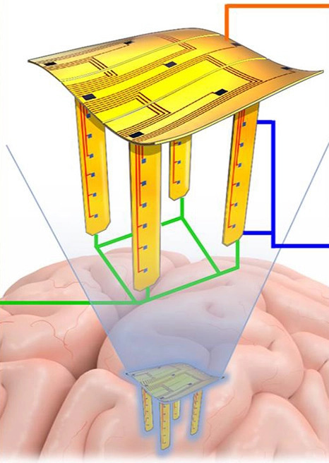 Pop-Up Electrode for Improved Neural Interfaces | In-Vitro Diagnostic | Scoop.it