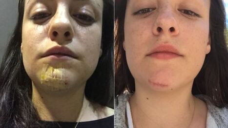 Complex’s Lauren Nostro Charges Ex-Boyfriend Ernest Baker With Assault, Harassment - Jezebel.com | Operation Oya | Scoop.it
